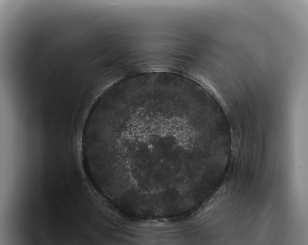 X0000094960386200712061316