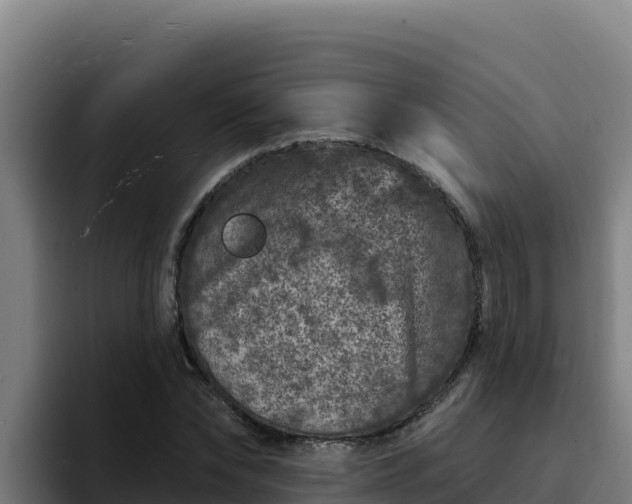 X0000094960878200712061309