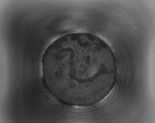 X0000094961171200712061305