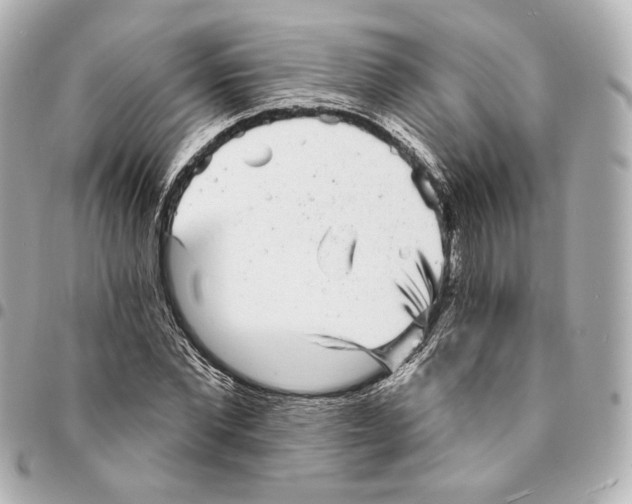 X0000094960877200712201158