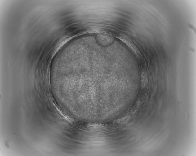 X0000094960886200712201158