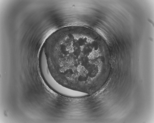 X0000094961087200712201155