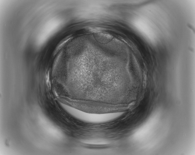 X0000094961198200712201153