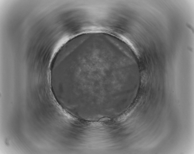 X0000094961472200712201149