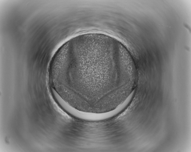 X0000094961518200712201148