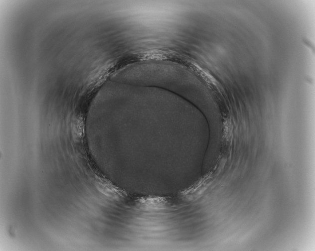 X0000094960517200712271722
