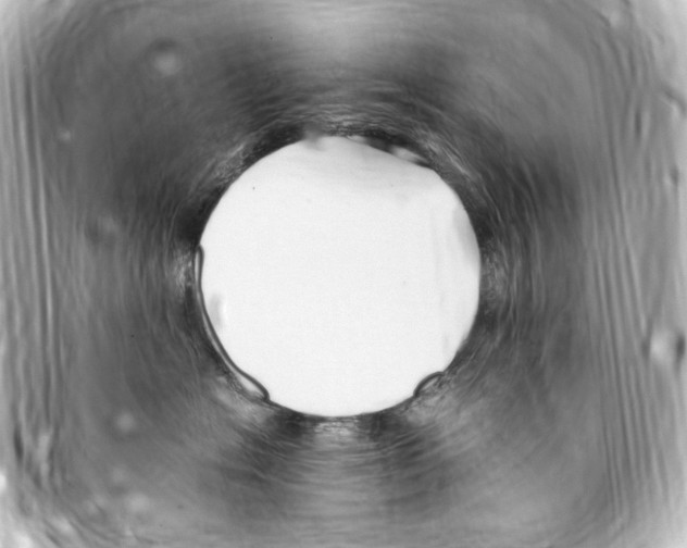 X0000094970574200712271745