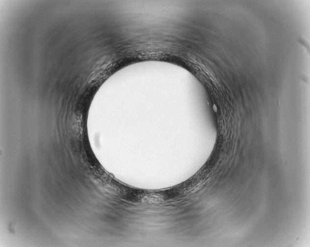 X0000094970599200712271744
