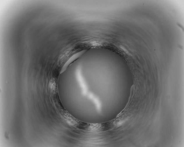 X0000095110720200712141152