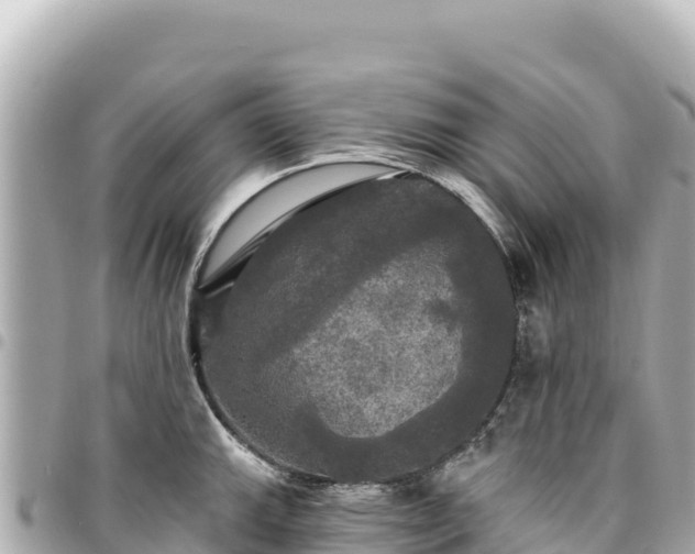 X0000095111143200712141146