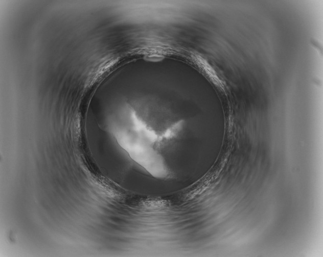 X0000095110202200712211328