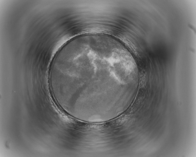 X0000095111086200712211315