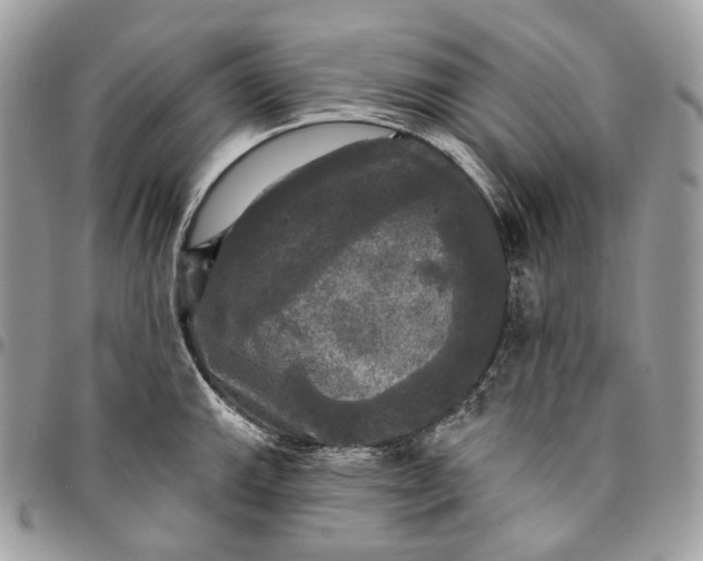 X0000095111143200712211315