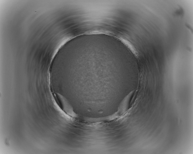 X0000095111476200712211310