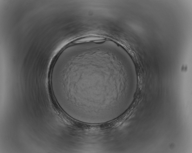 X0000095110196200712301745