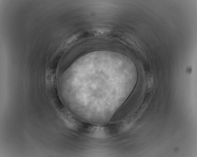 X0000095110276200712301744