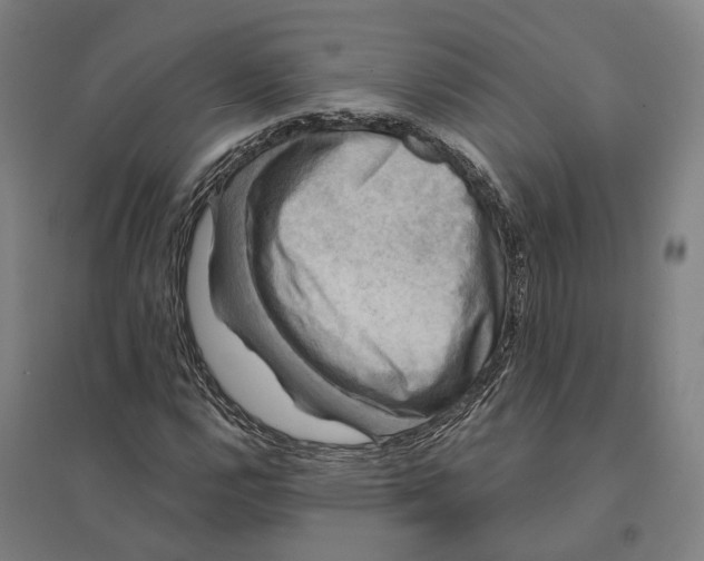 X0000095111112200712301730