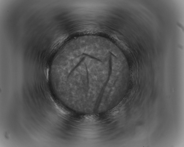 X0000095110070200801041210