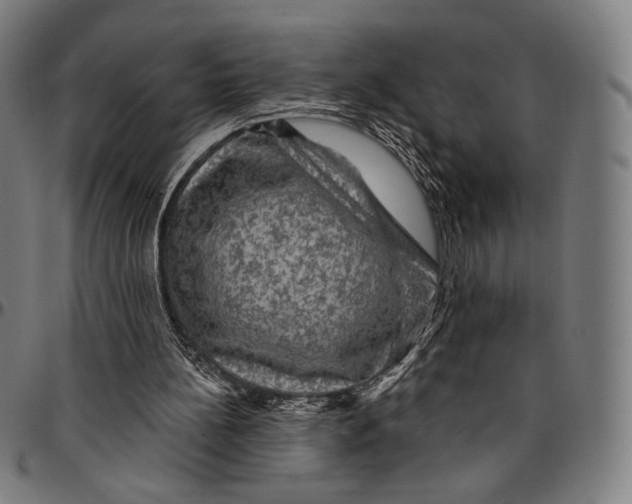 X0000095110148200801041208