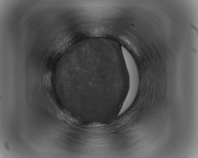 X0000095110217200801041207