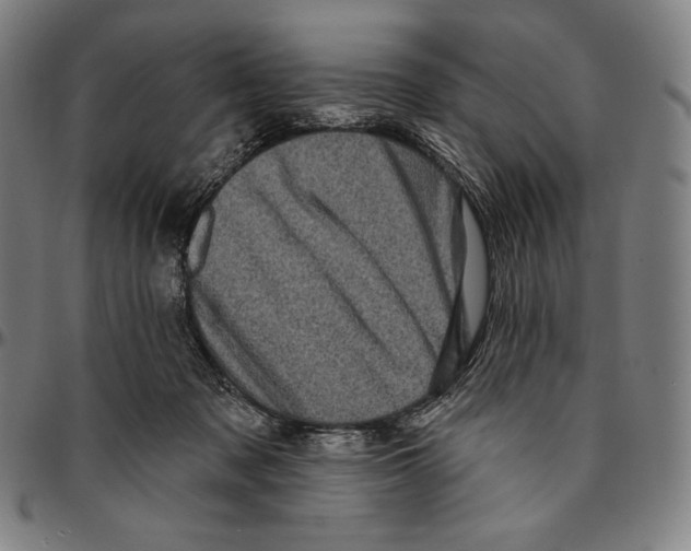 X0000095110317200801041206