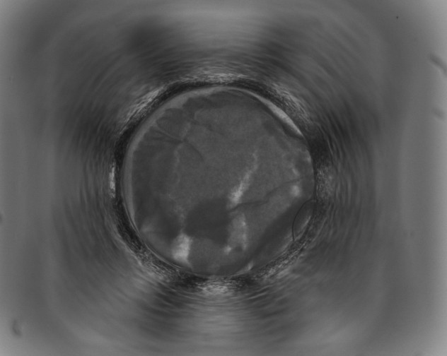 X0000095110358200801041205
