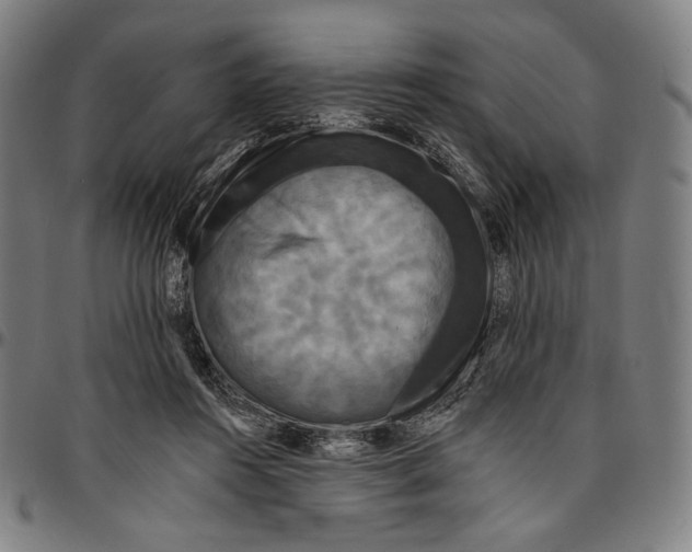 X0000095110360200801041205