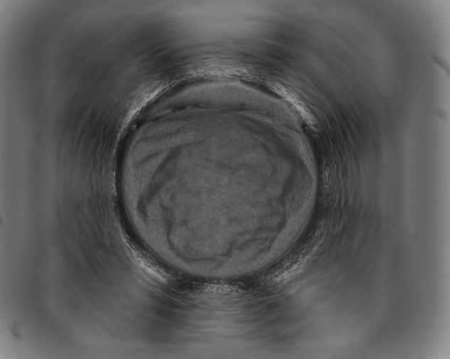 X0000095110399200801041205