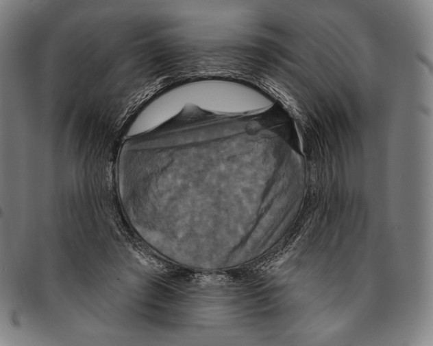 X0000095110401200801041205