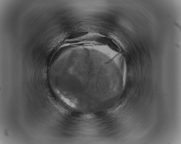 X0000095110402200801041205