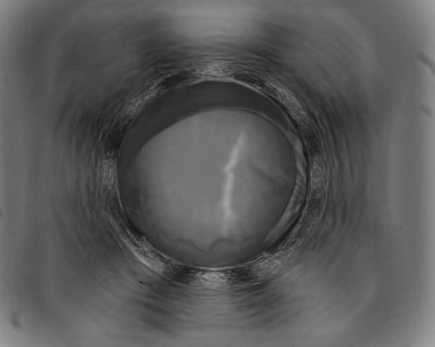 X0000095110409200801041205