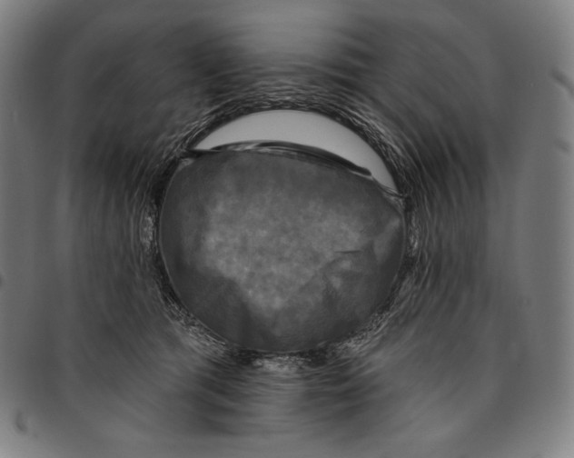 X0000095110417200801041205