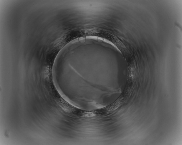 X0000095110519200801041203