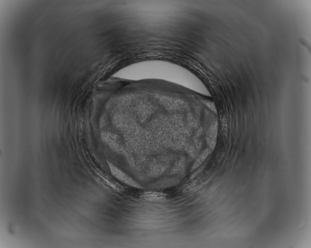 X0000095110617200801041201