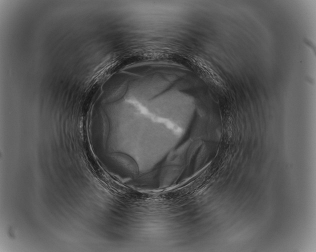 X0000095110696200801041200