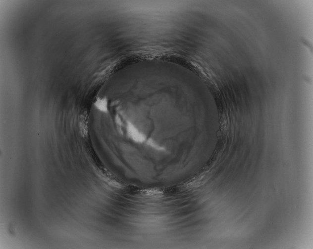 X0000095110719200801041200