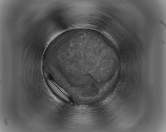 X0000095110846200801041158