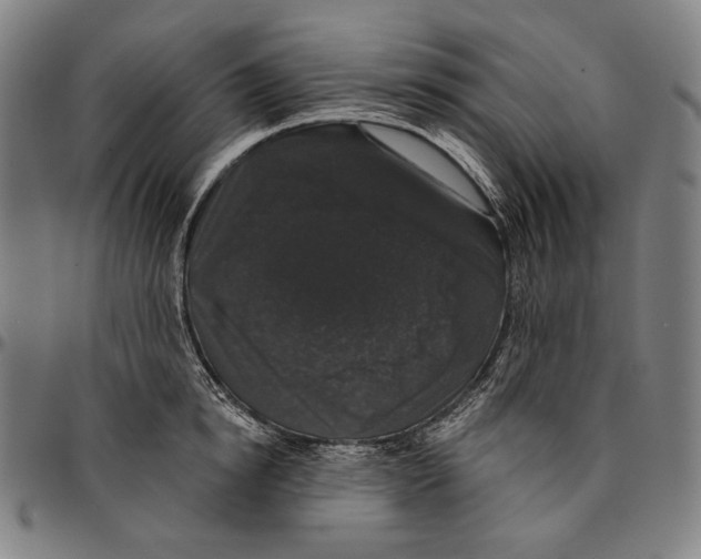 X0000095110854200801041158
