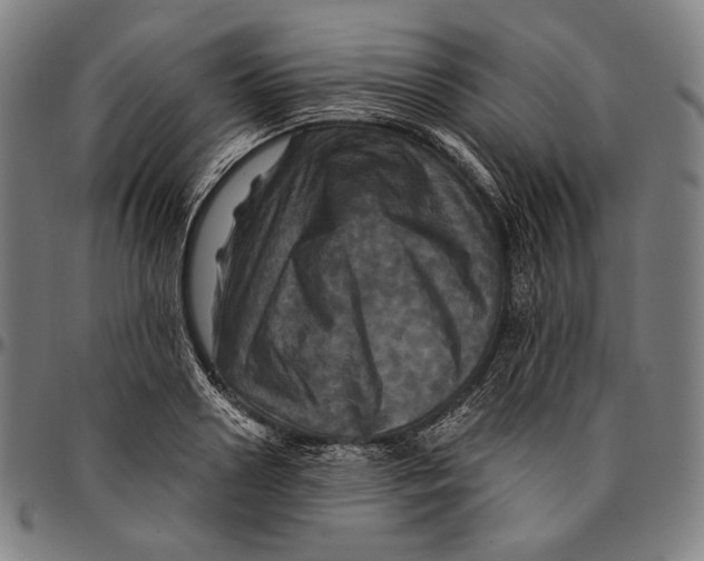 X0000095110938200801041157