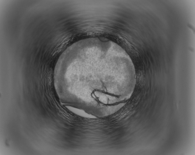 X0000095111012200801041155