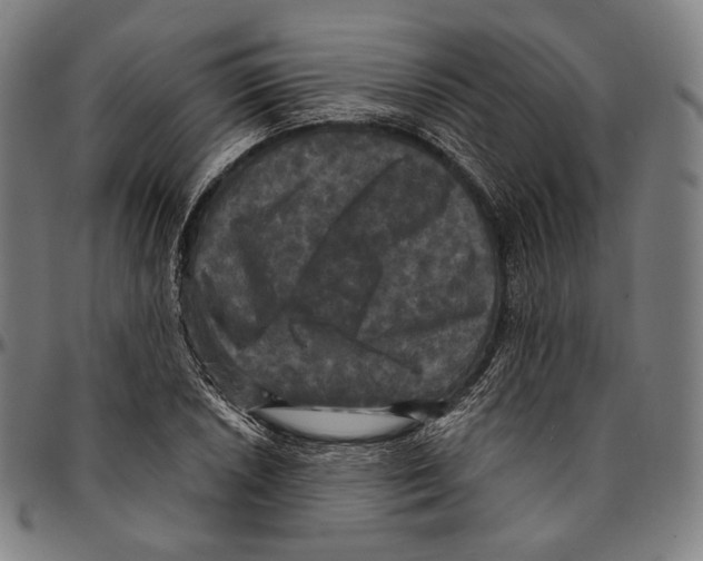 X0000095111026200801041155