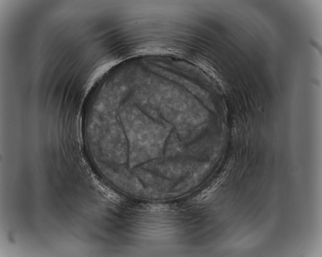 X0000095111030200801041155