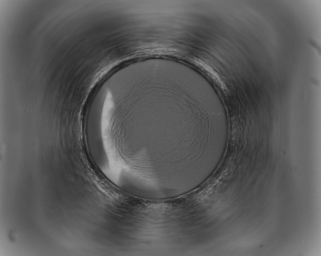 X0000095111031200801041155