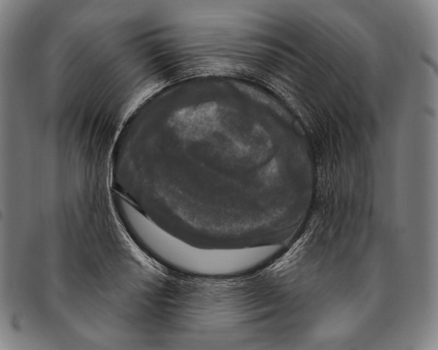 X0000095111034200801041155