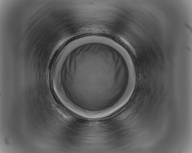 X0000095111035200801041155