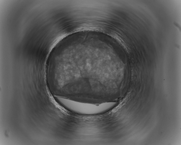 X0000095111038200801041156