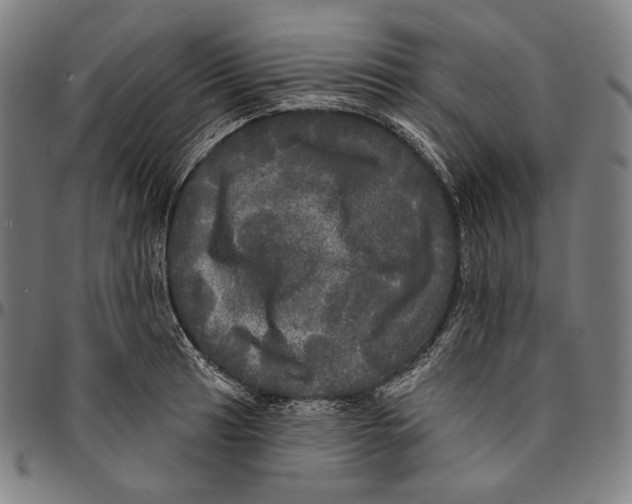 X0000095111041200801041156