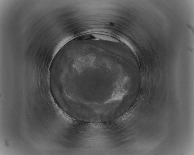 X0000095111050200801041156