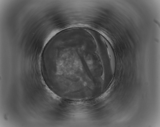 X0000095111054200801041156