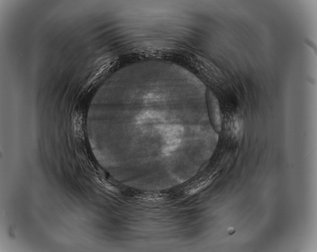 X0000095111060200801041155